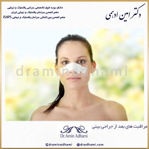 مراقبت های بعد از جراحی بینی