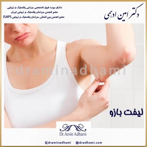 لیفت بازو