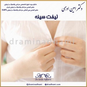 لیفت سینه