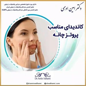 پروتز چانه