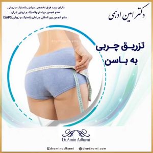تزریق چربی به باسن