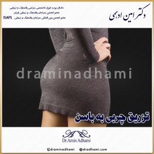تزریق چربی به باسن