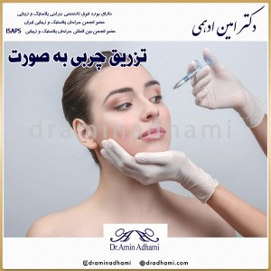 تزریق چربی به صورت