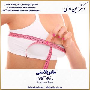 ماموپلاستی