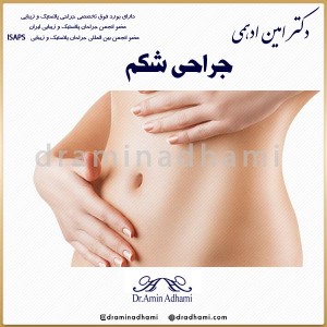 جراحی شکم
