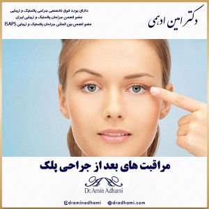 مراقبت های بعد از جراحی پلک