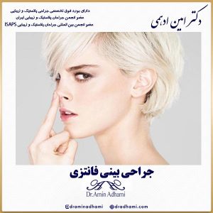 جراحی بینی فانتزی