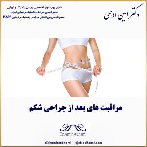 مراقبت های بعد از جراحی شکم