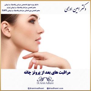 مراقبت های بعد از پروتز چانه