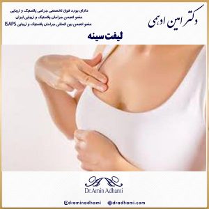 لیفت سینه