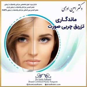 تزریق چربی به صورت